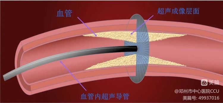 微信图片_20230413111341.jpg